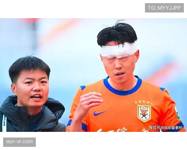 2026世界杯比赛中球员脑震荡换人规则是什么